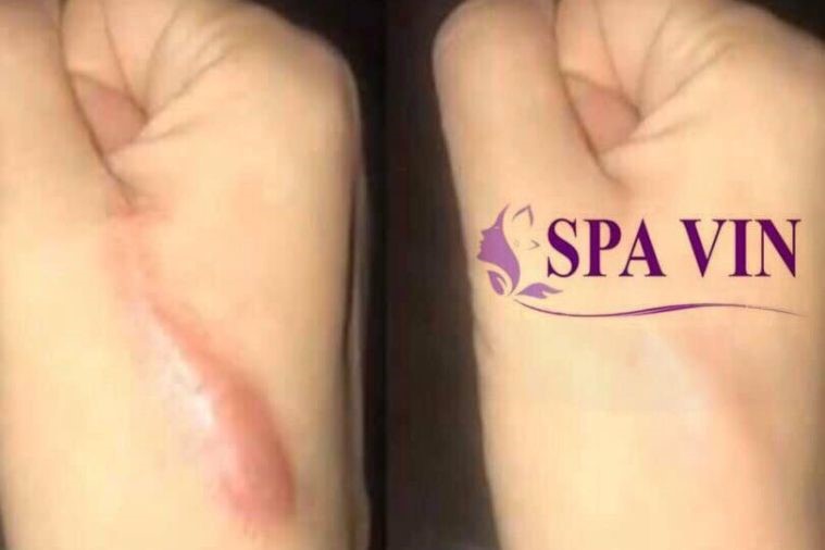 The Vin Spa - Đà Lạt