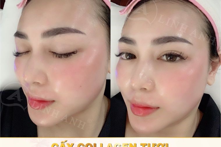 Thẩm mỹ Quốc tế Linh Anh - Phan Thiết