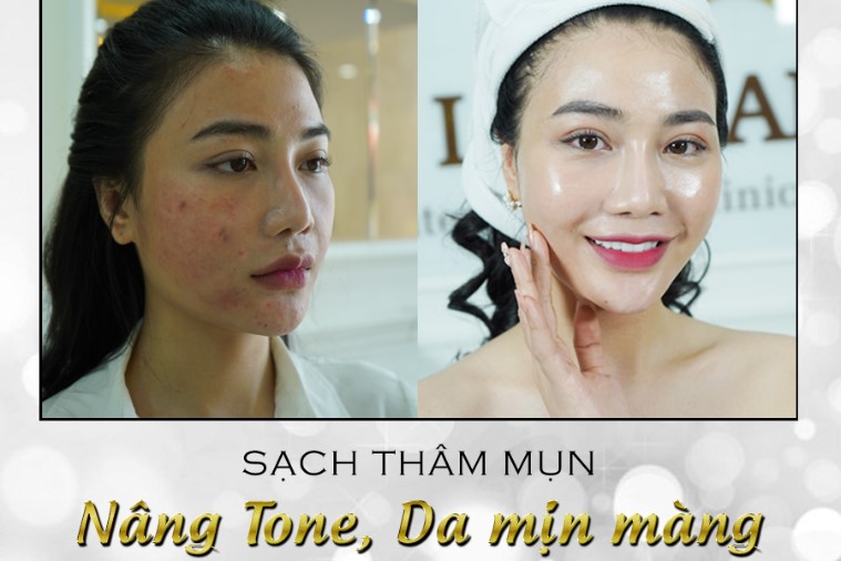 Thẩm mỹ Quốc tế Linh Anh - Phan Thiết